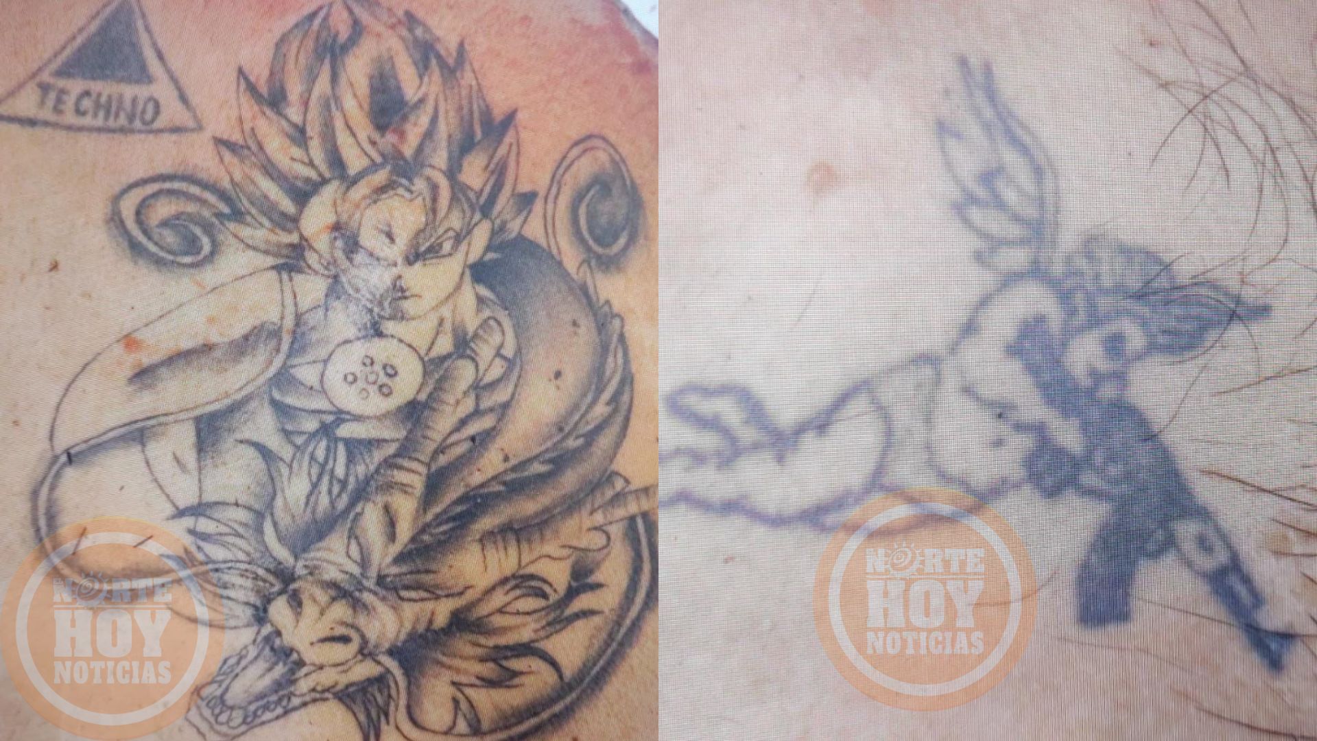 Por medio de tatuajes buscan identificar cuerpo hallado en Cartago