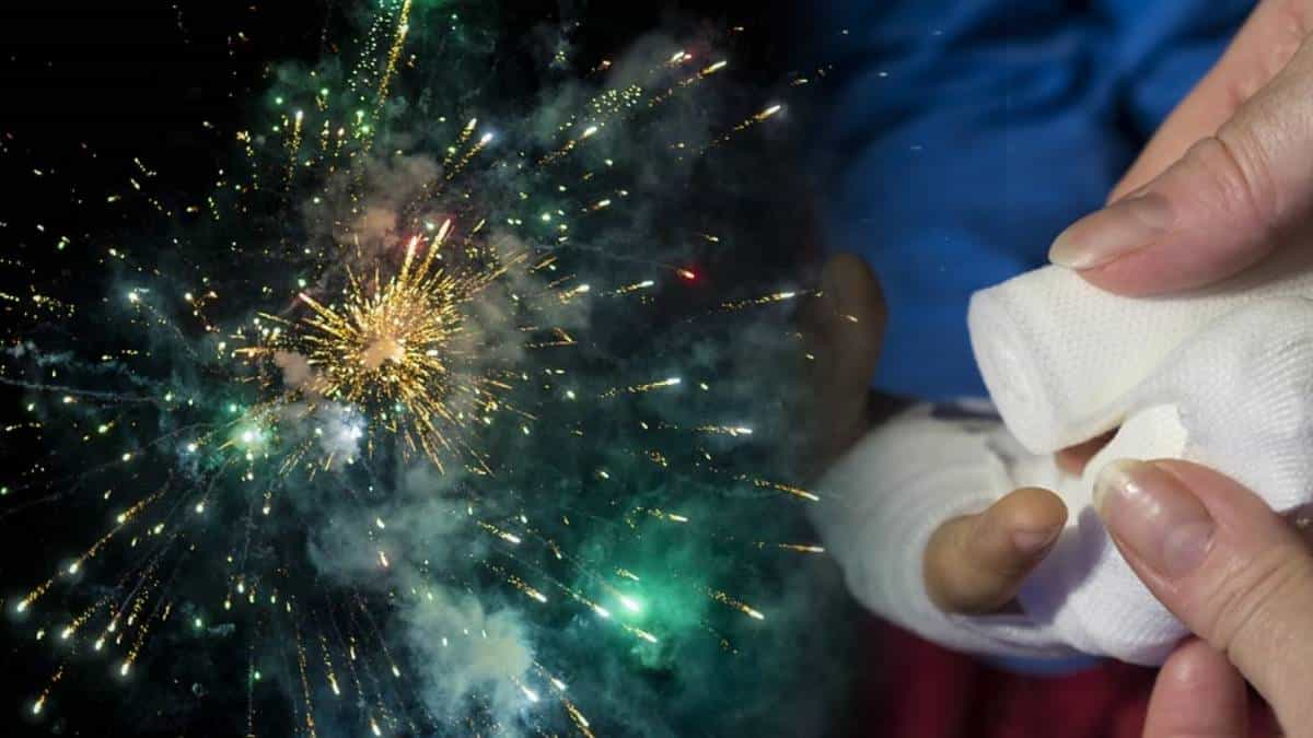 Más casos de quemados por pólvora en el Valle, uno de ellos en Cartago.