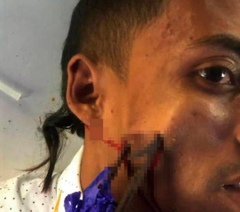 Video: Hombre se clavó su propia banderilla en el rostro.