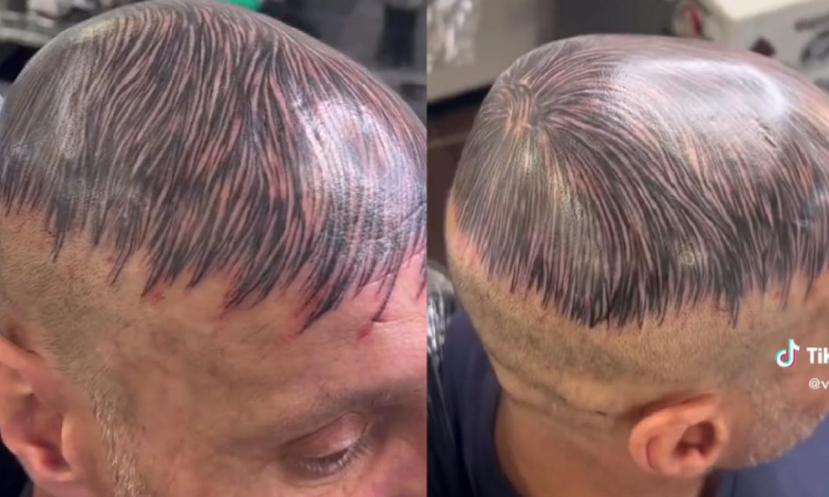 Hombre se tatúa "pelo" en su cabeza rapada para ocultar su calvicie y se vuelve viral en TikTok