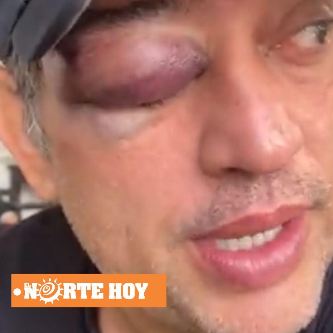Hijo de Rodolfo Hernández agredido por defender ideales políticos.