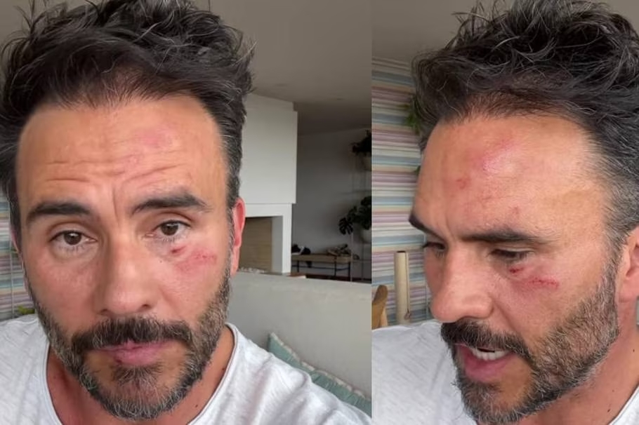 Actor Juan Pablo Raba y sus hijos sufren asalto en Bogotá