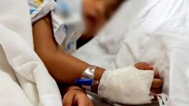 Niña de Tres Años Sufrió Graves Quemaduras con Aguapanela