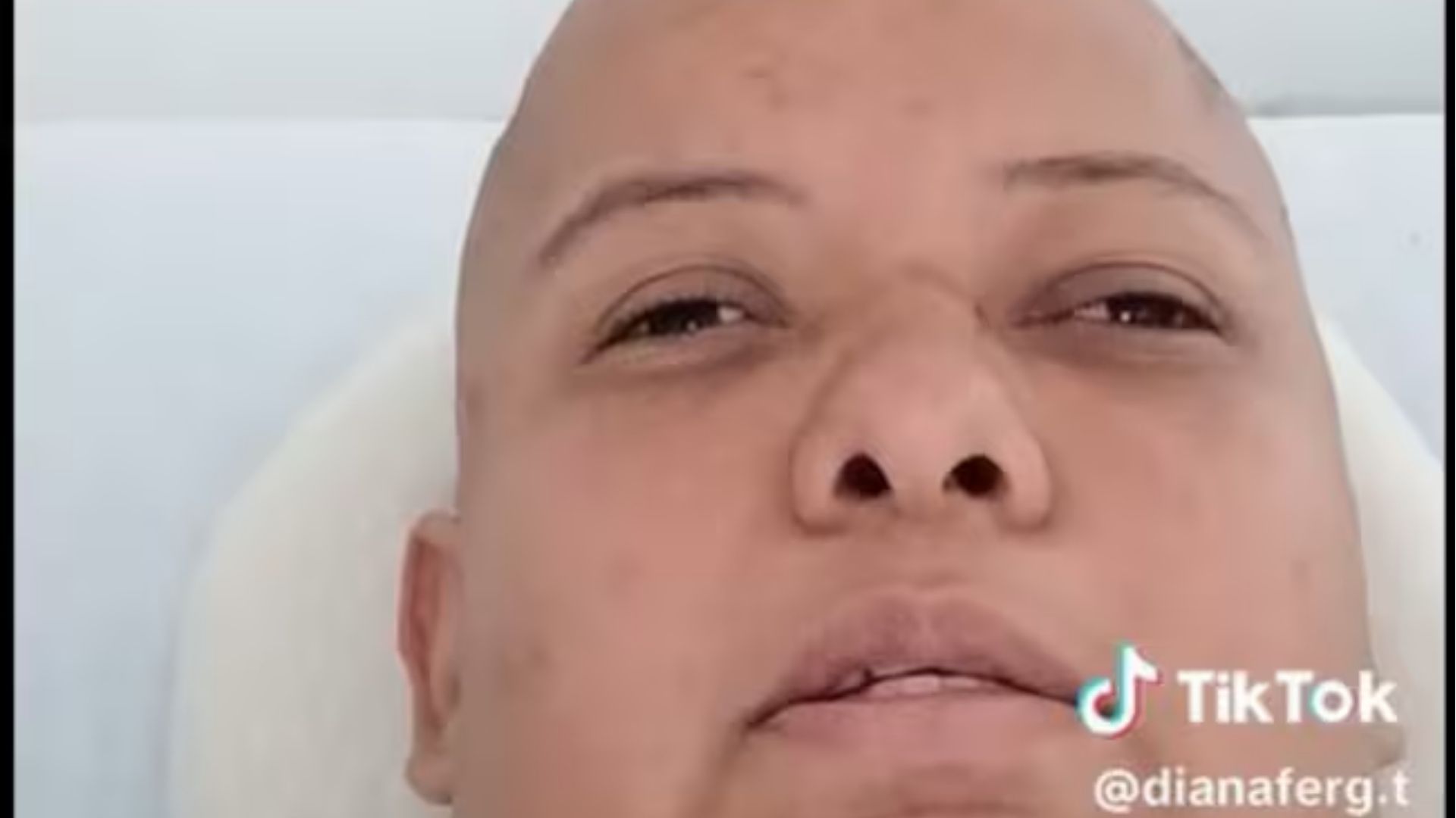 Denuncia de una mujer con tumor cerebral a la EPS Sanitas