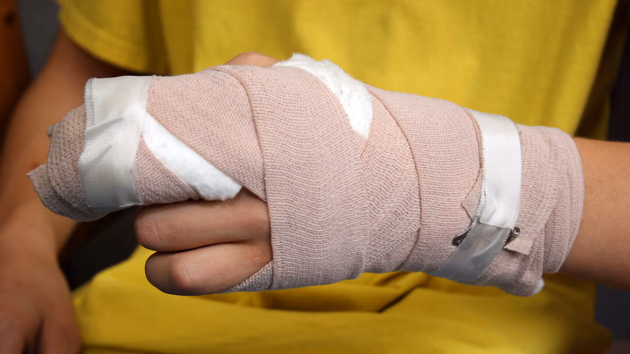 Evita usar pólvora: protege tu salud y la de tu familia estas fiestas