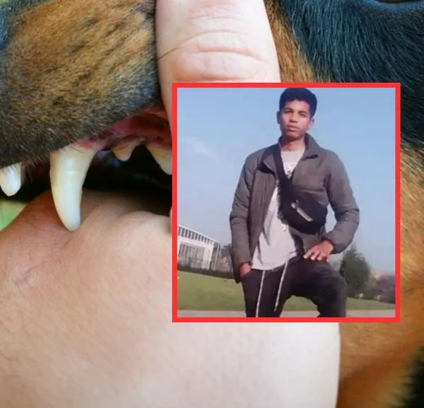 Joven atacado por perros pierde los brazos y está en UCI