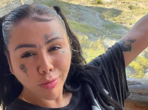 Yina Calderón revela el impactante estado de sus glúteos tras múltiples