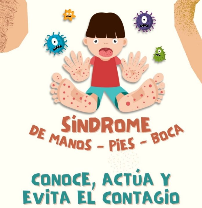 Niños en aula de preescolar con medidas de bioseguridad por brote de síndrome mano-pie-boca en Tuluá.