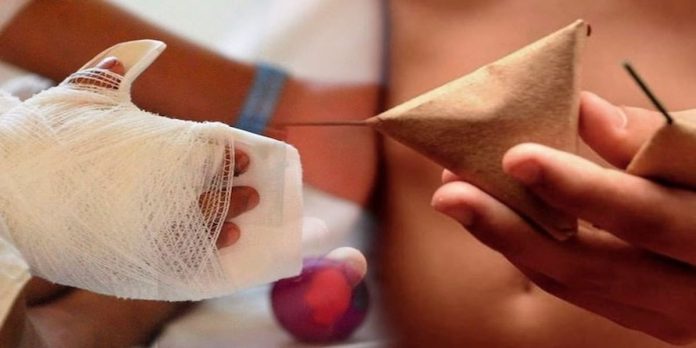 Lesionados por pólvora generan alerta sanitaria en la primera noche de Velitas